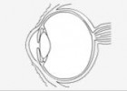 Cirugía láser para los ojos | Recurso educativo 45736