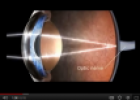 Video: Human eye | Recurso educativo 77390