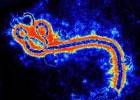 adn-dna: 389- Asesinos microscópicos: el virus del Ébola | Recurso educativo 680299